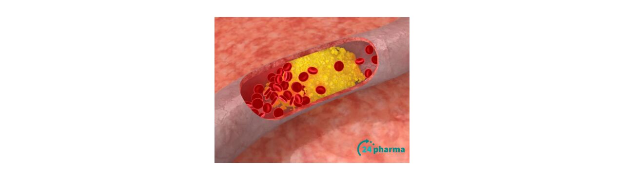 Tips om cholesterol te verlagen